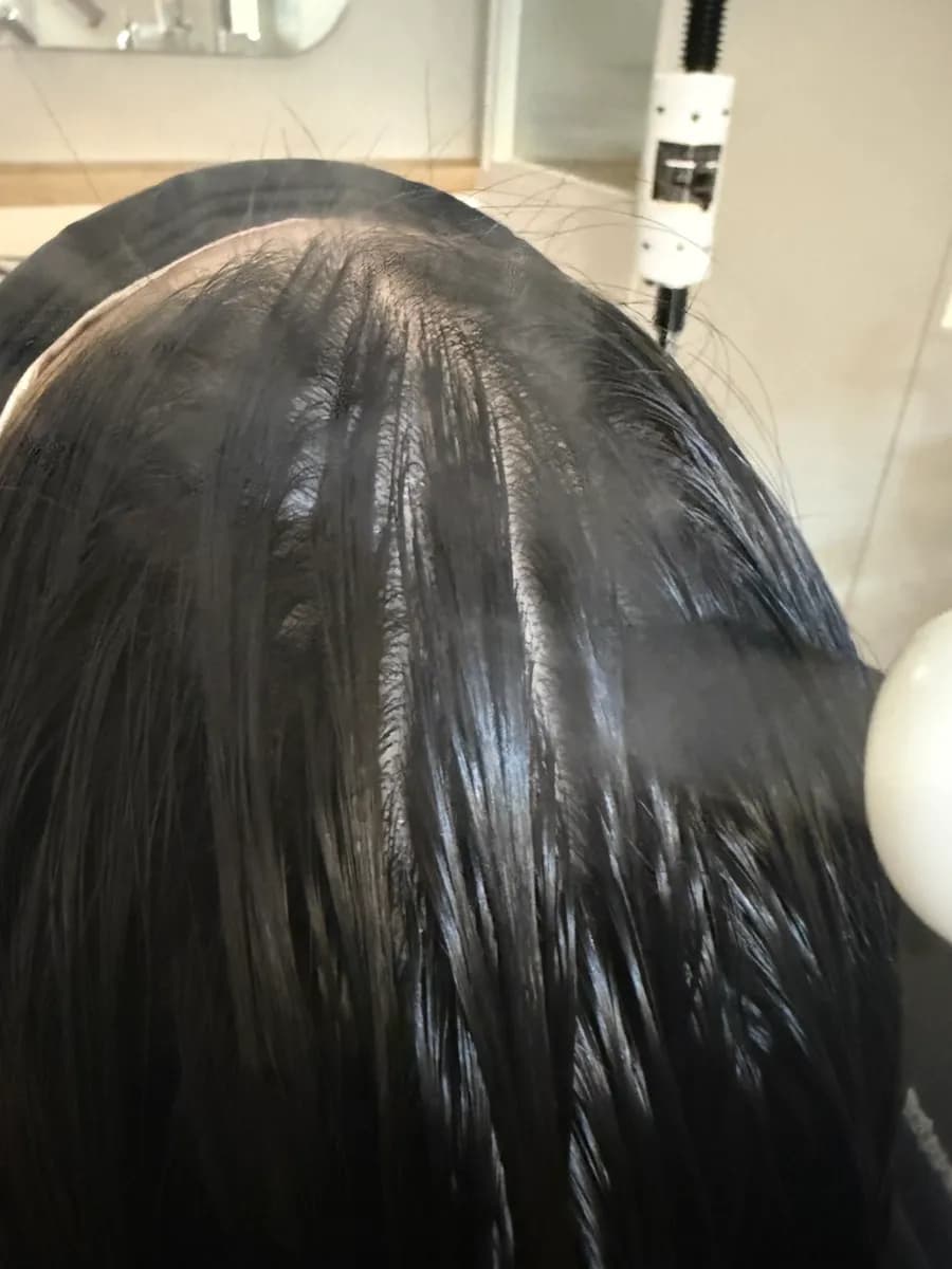 Moving from shampoo care to the intensive scalp care stage