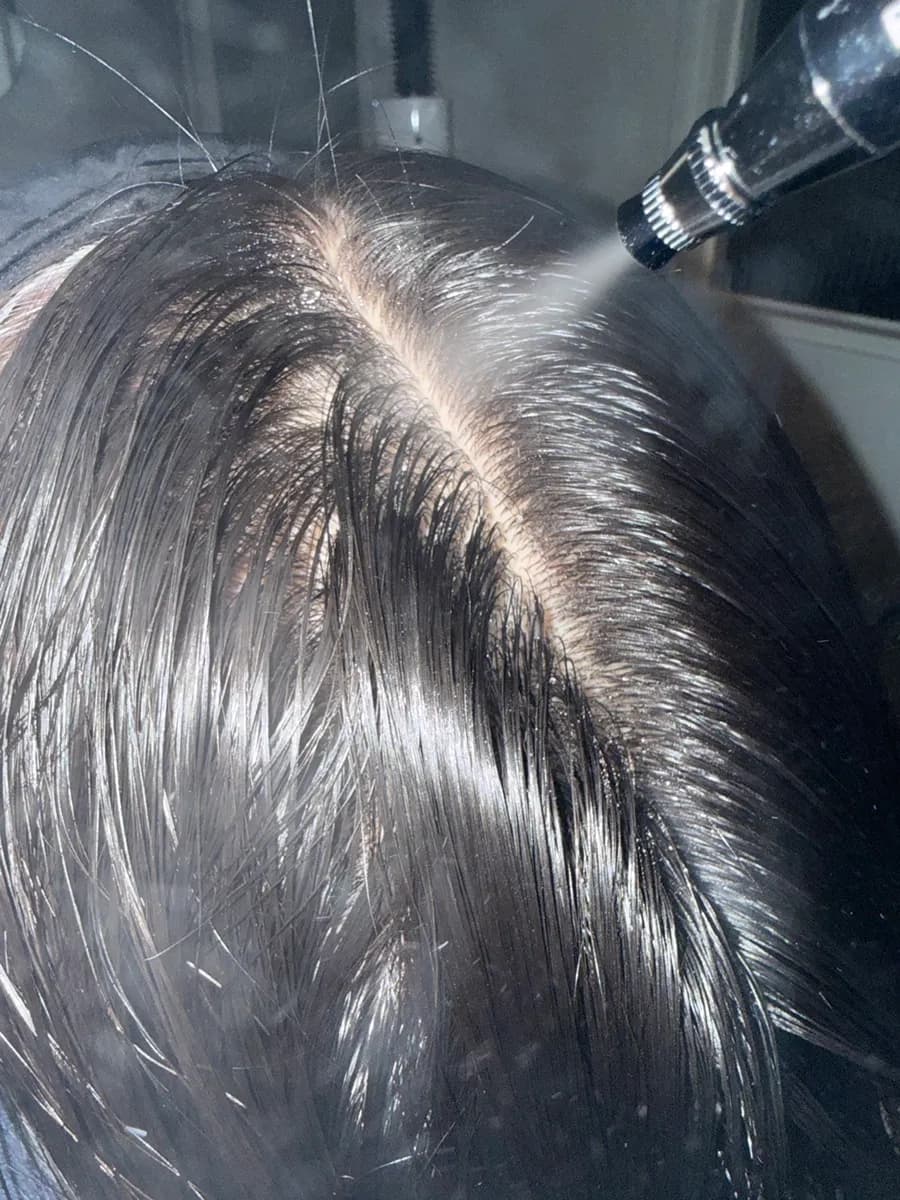 Intensive room for adding nutrition to the clean scalp