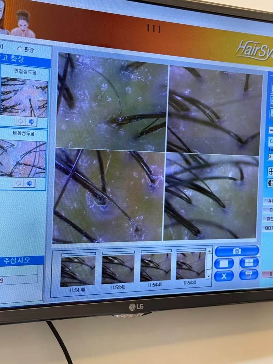 Tonic and Bio Light step during Top Scalp Anyang intensive care