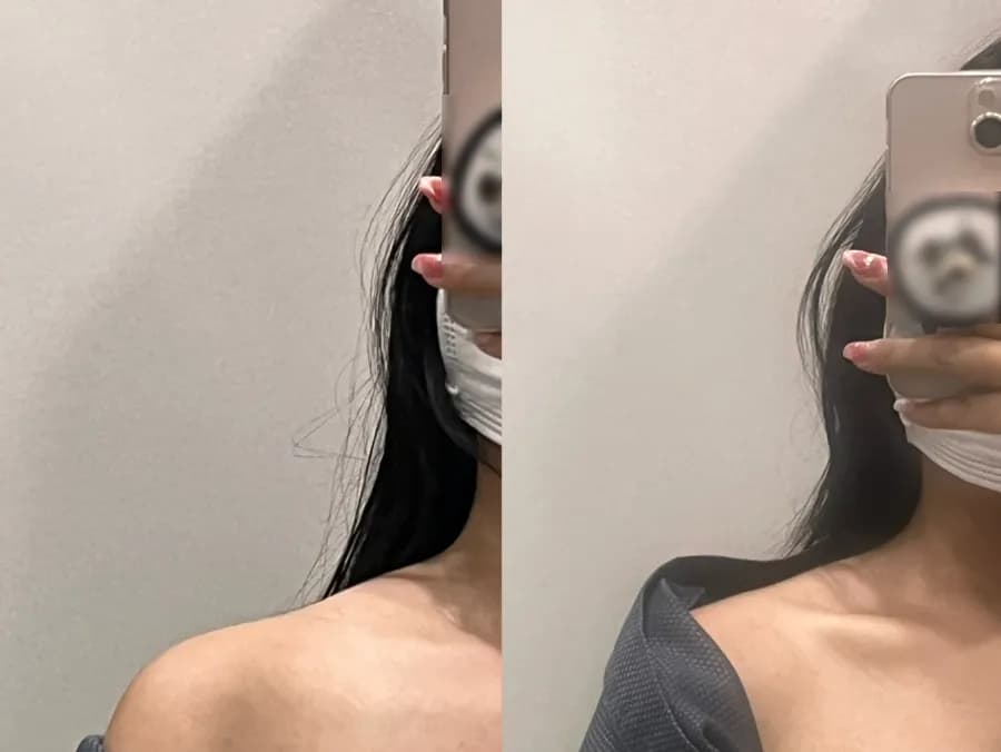 안양 평촌 마사지 타이 앤 웰빙- 승모근 뿌시기 어깨 결림 해결!