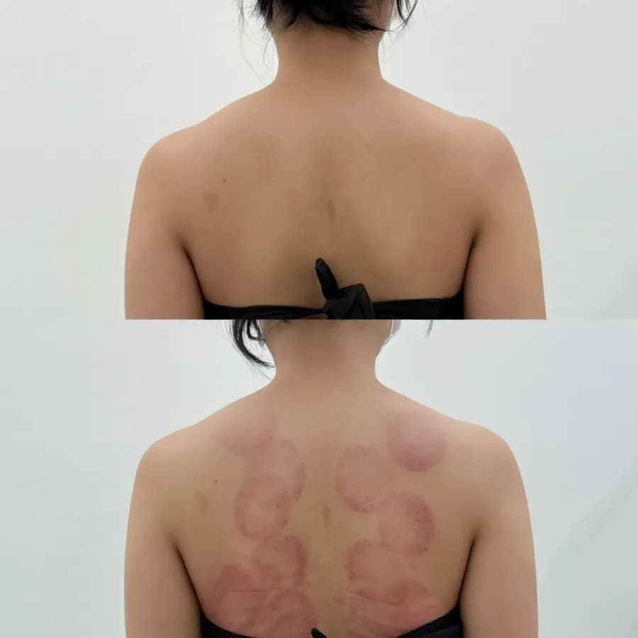 Ulasan terapi tenaga penjagaan badan Benefit Aesthetic di Sanbon
