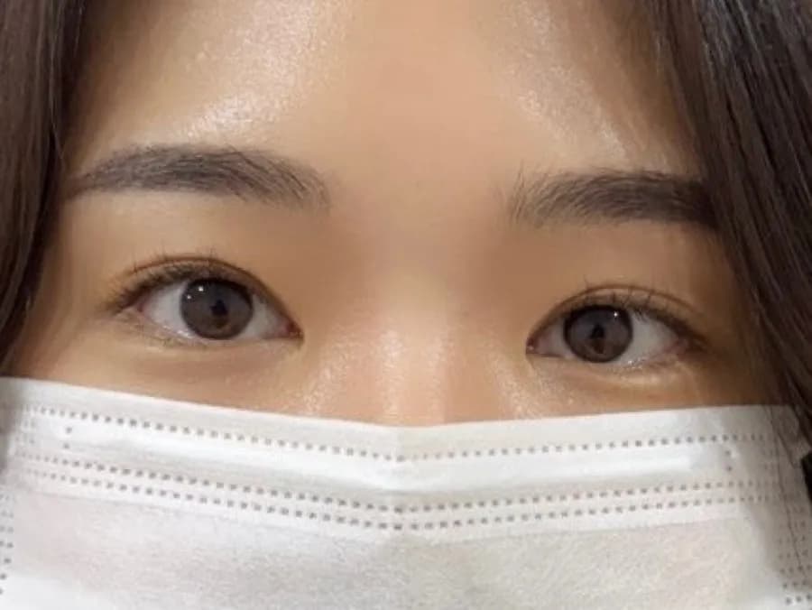 Before and after Sanbon eyelash perm result at Roa Lash