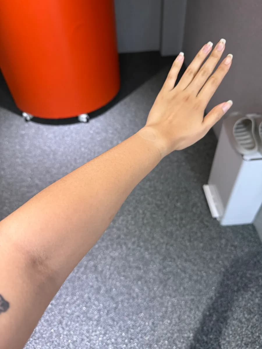 Trước và sau buổi white tanning đầu tiên tại Tanning Now Sanbon