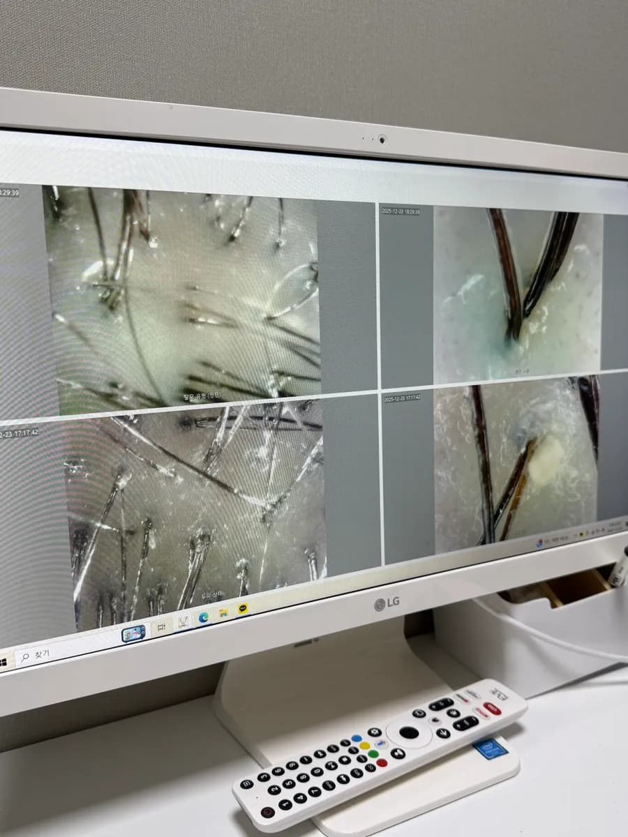 Cuidado posterior para equilibrar grasa y humedad del cuero cabelludo