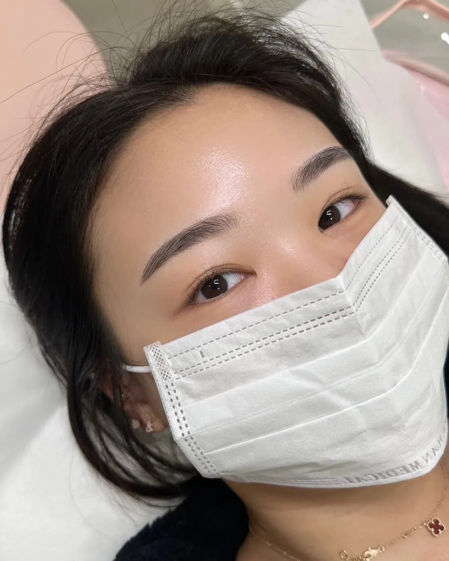 Kết quả trước và sau của uốn mi trên và dưới tại Damong Lash