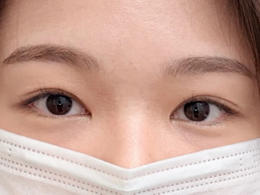 Vorher-Nachher-Ergebnis von Wimpernlifting mit Point Extensions